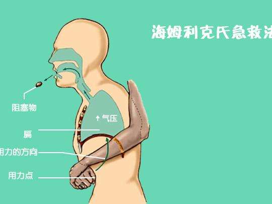 吞咽異物可致死 兩種救護(hù)措施要牢記